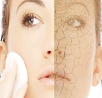 5 Bước cơ bản chăm sóc làn da khô của bạn